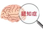 肘の内側・外側・両側、部位別の痛みの原因と治療法　肘の骨を押すと痛いのはなぜ？原因・病気を解説！