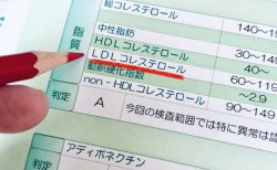 高くても低くてもダメ！医者が教えるコレステロールの上手なコントロール法